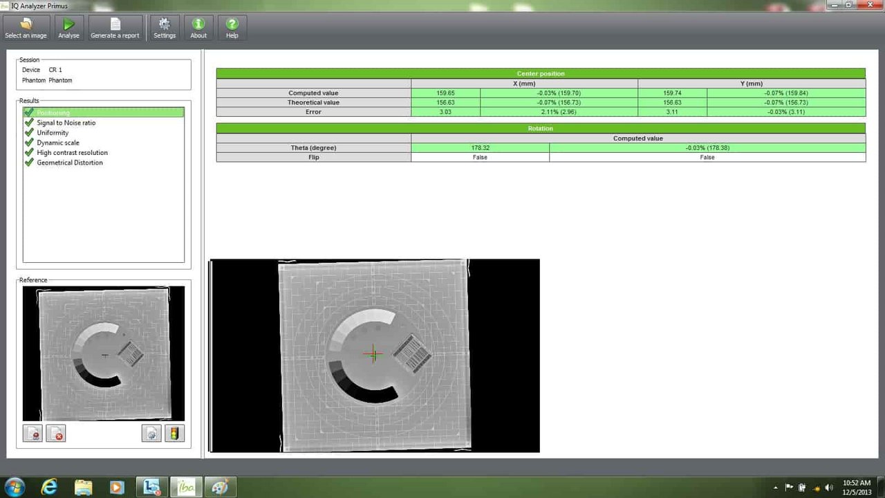 IBA Dosimetry IQ Analyzer Primus positioning Screen 