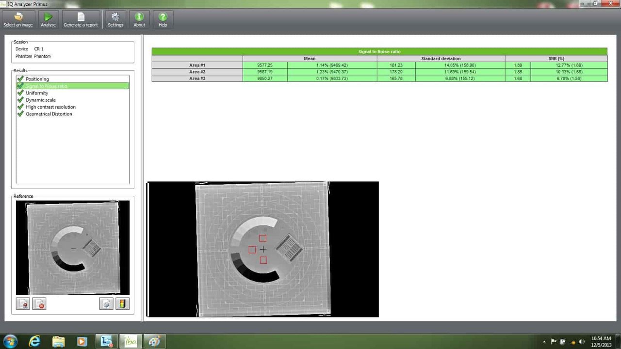 IBA Dosimetry IQ Analyzer Primus Signal Noise Screen 