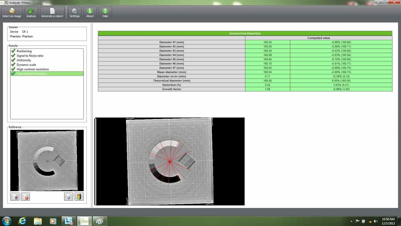 IBA Dosimetry IQ Analyzer Primus Geometric Distortion Screen 