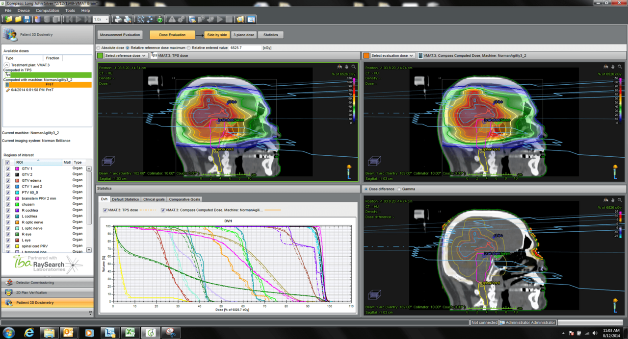 IBA Dosimetry Radiation Product COMPASS Brain Case