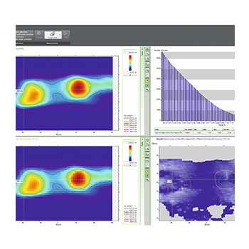 iba dosimetry myqa srs - worflow efficiency for srs measurement