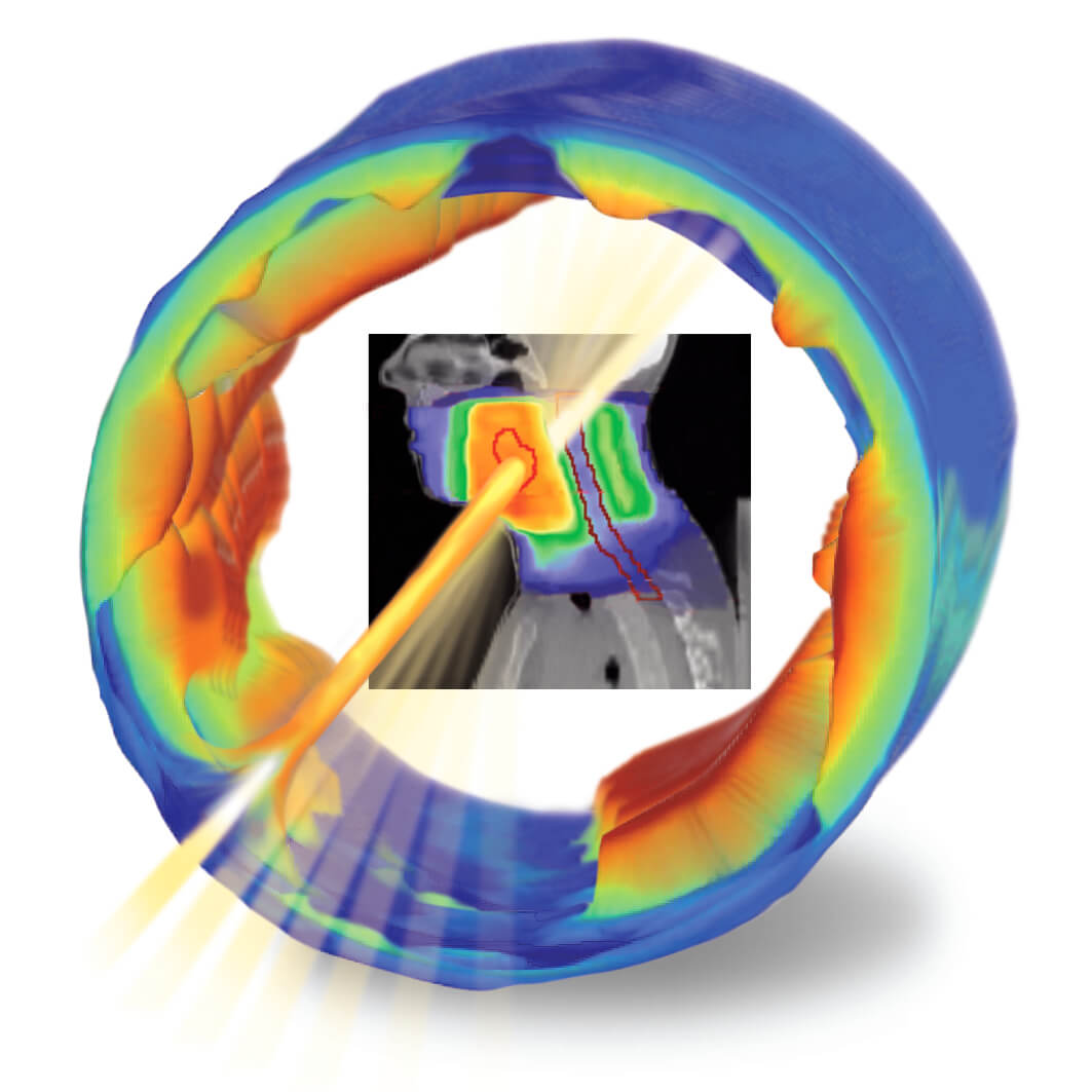 IBA Dosimetry Radiation Product COMPASS 3D Software Dose
